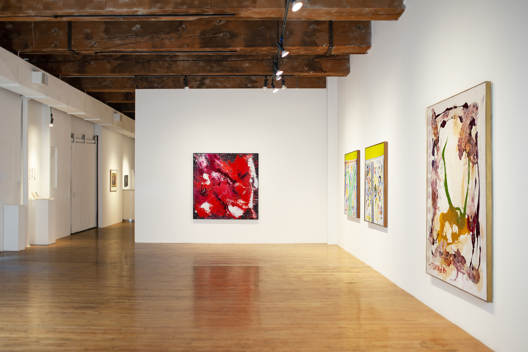 Ronald After 25 Years Install 1